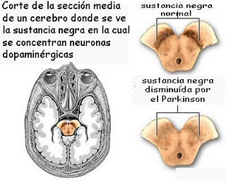 cerebro